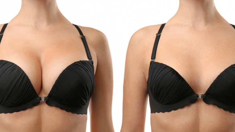 Breast Lift Surgery in Pune  No.1 Clinic - Dr Shilpy Dolas