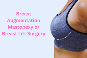 breast aumentation mastopexy
